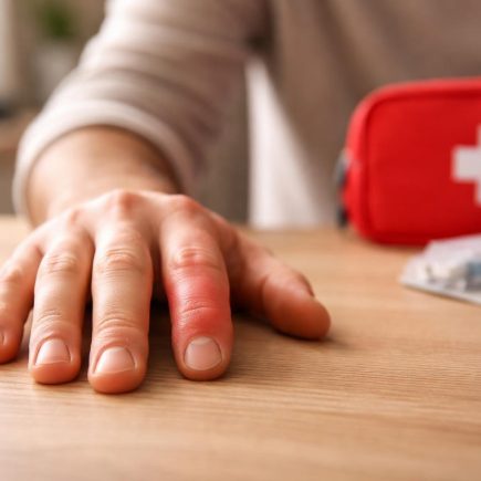 main-doigt-gonfle-trousse-soins